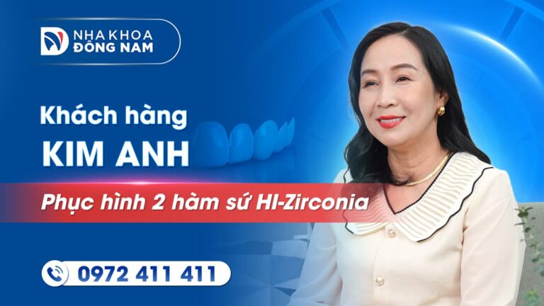 Khách hàng Kim Anh làm 20 răng sứ thẩm mỹ