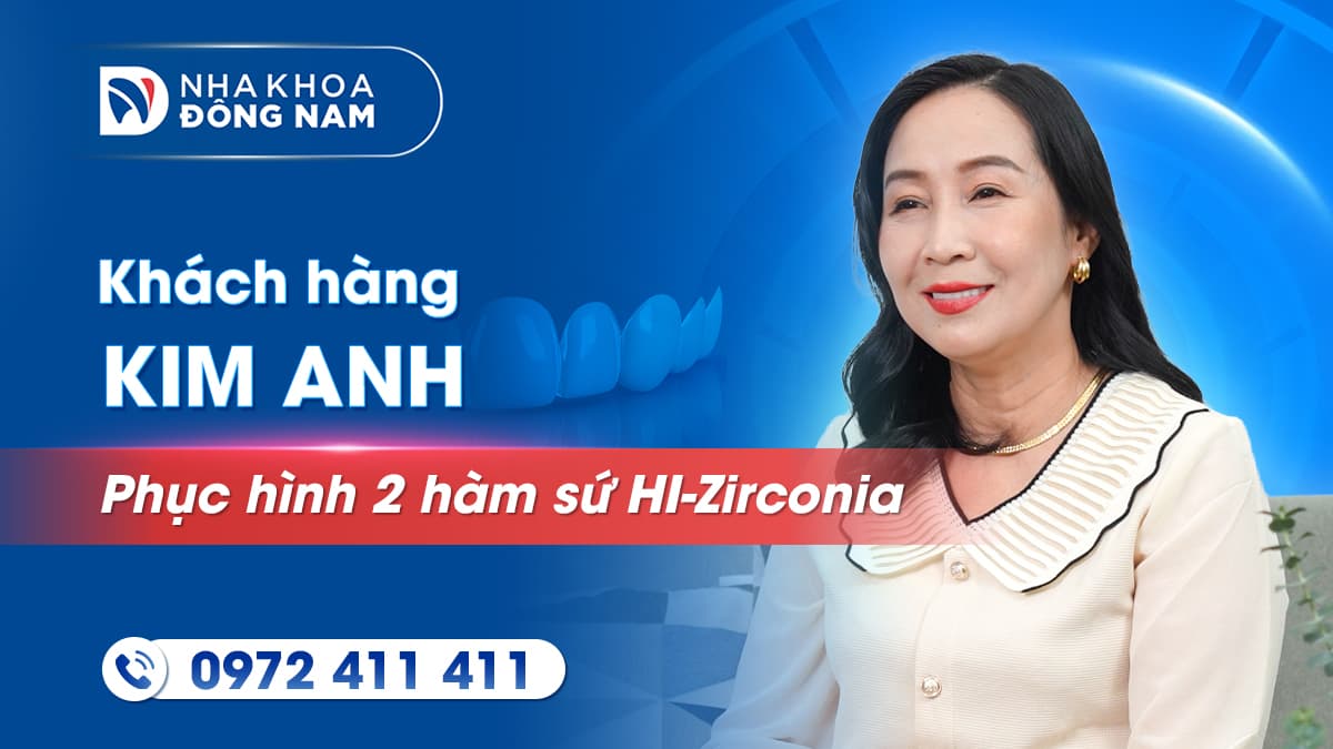 review khách hàng kim anh làm 2 hàm răng sứ thẩm mỹ