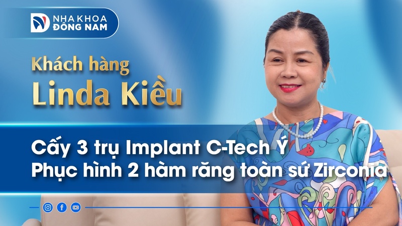 review khách hàng linda kiều cấy 3 trụ implant Ý