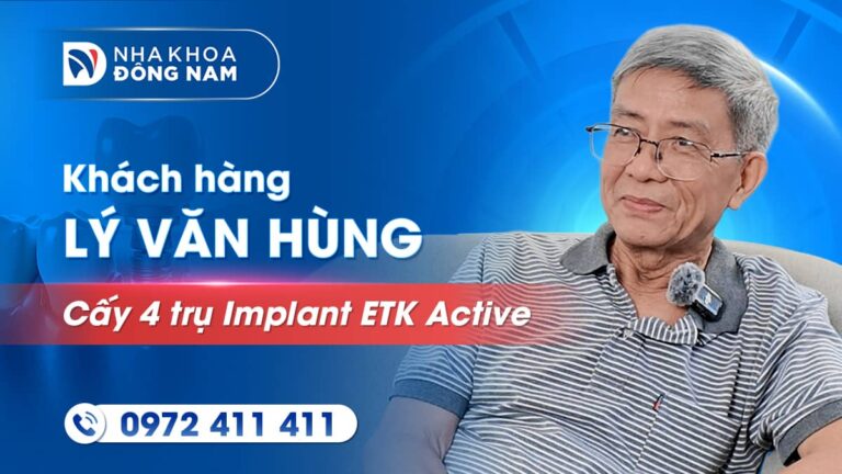 Khách hàng Lý Văn Hùng cấy 4 trụ Implant và phục hình răng sứ 2 hàm