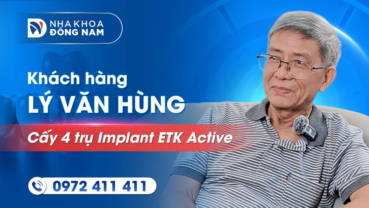 review khách hàng lý văn hùng cấy 4 trụ implant