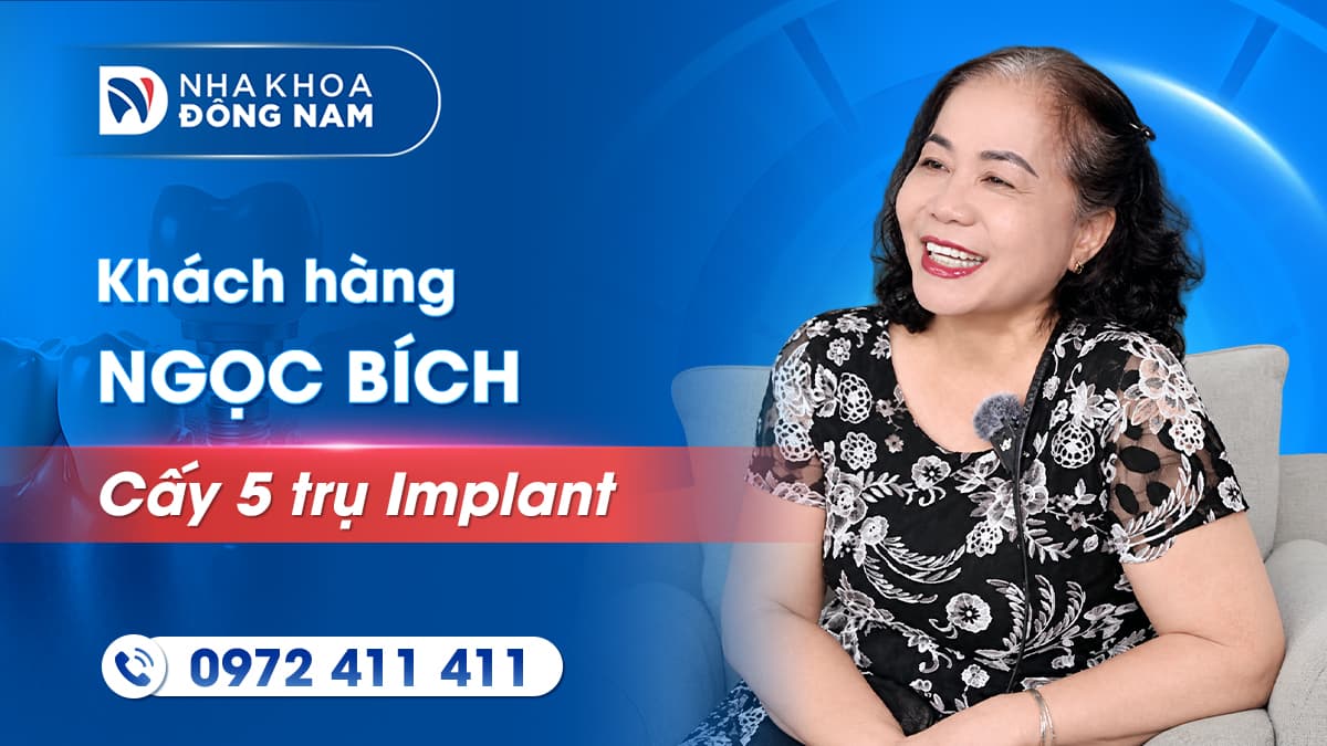 review khách hàng ngọc bích cấy 5 trụ implant và phục hình răng sứ