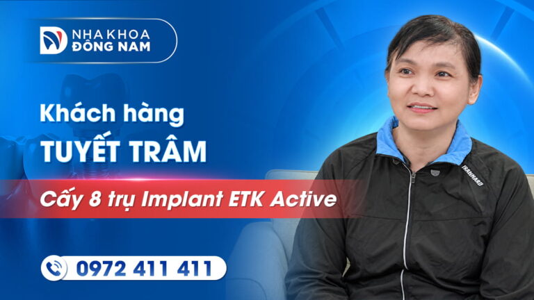 Khách hàng Phạm Thị Tuyết Trâm cấy 8 trụ Implant pháp ETK Active
