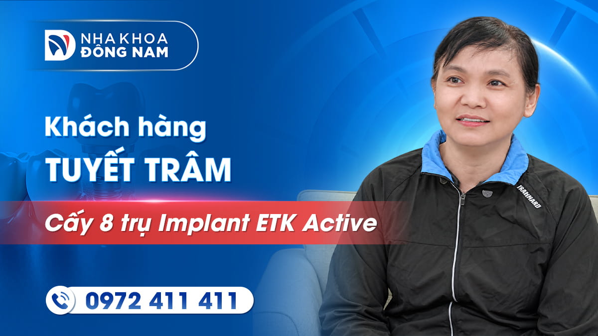review khách hàng phạm thị tuyết trâm cấy 8 trụ implant