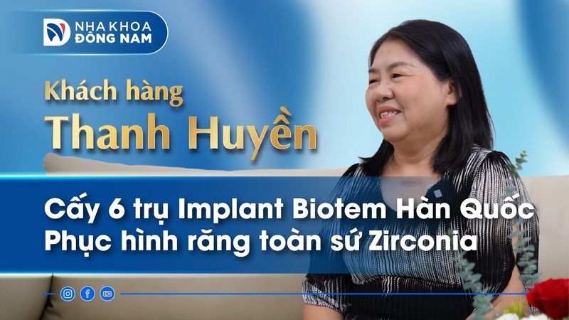 Cô Thanh Huyền cấy Implant phục hồi răng mất tại Nha Khoa Đông Nam