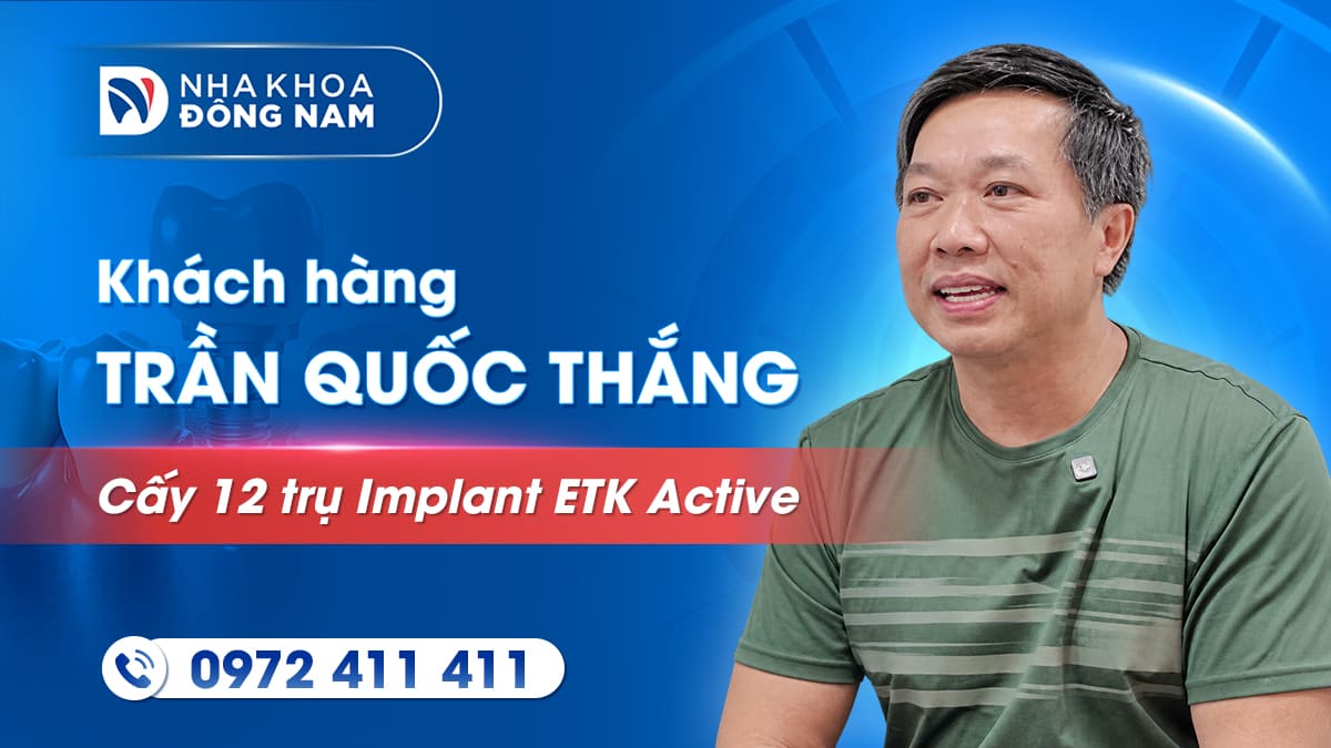 review khách hàng trần quốc thắng cấy 12 trụ implant active