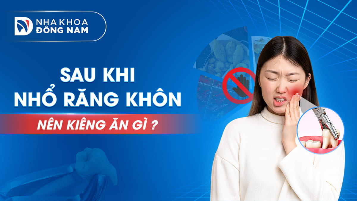 sau khi nhổ răng khôn kiêng ăn gì