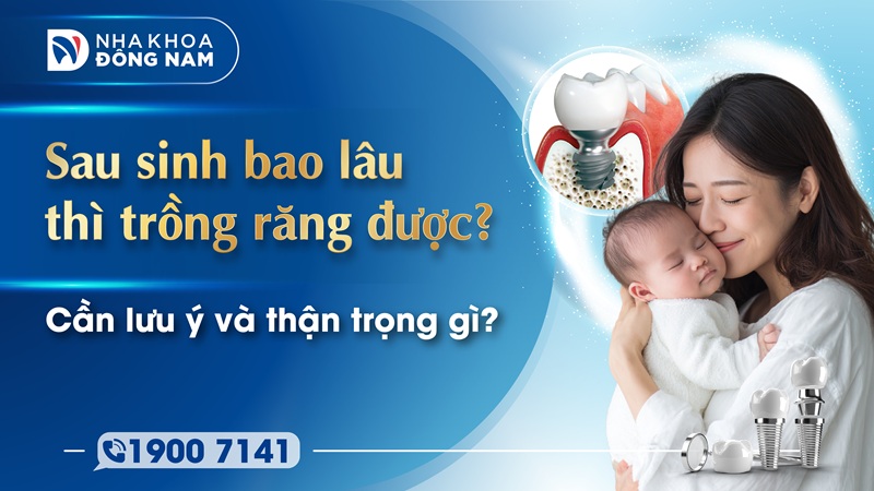 sau sinh bao lâu thì trồng răng được