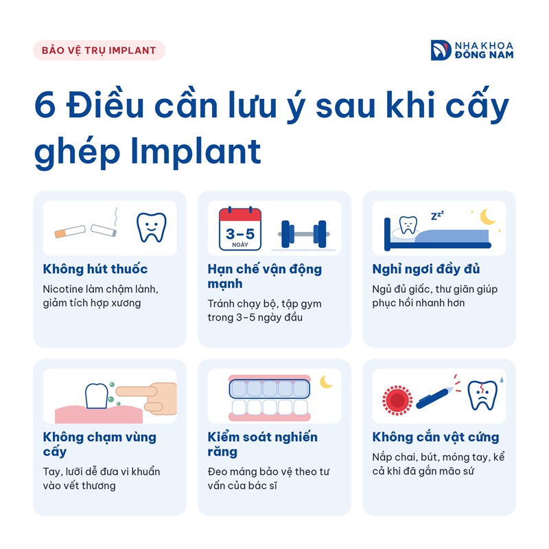thói quen sinh hoạt bảo vệ trụ implant