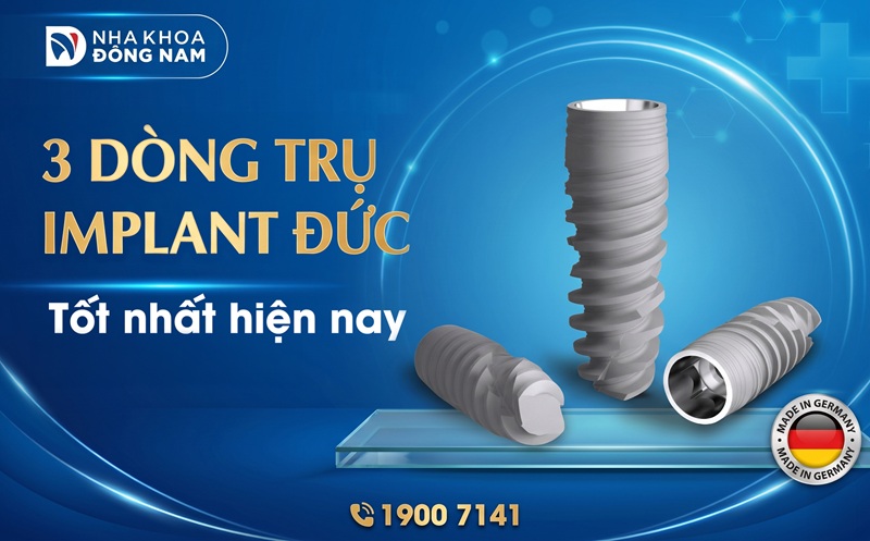 top 3 dòng trụ implant Đức tốt nhất hiện nay