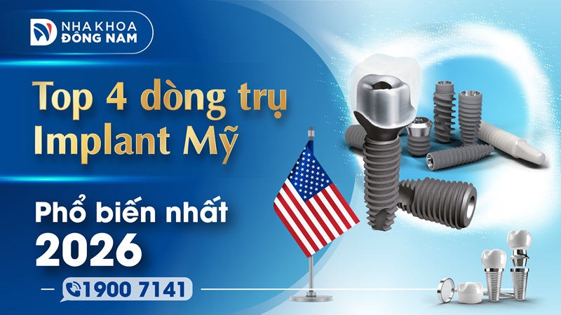 Top 4 dòng trụ Implant Mỹ tốt nhất trên thị trường hiện nay