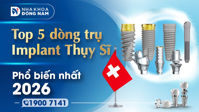 top 5 dòng trụ implant thụy sĩ phổ biến nhất 2025