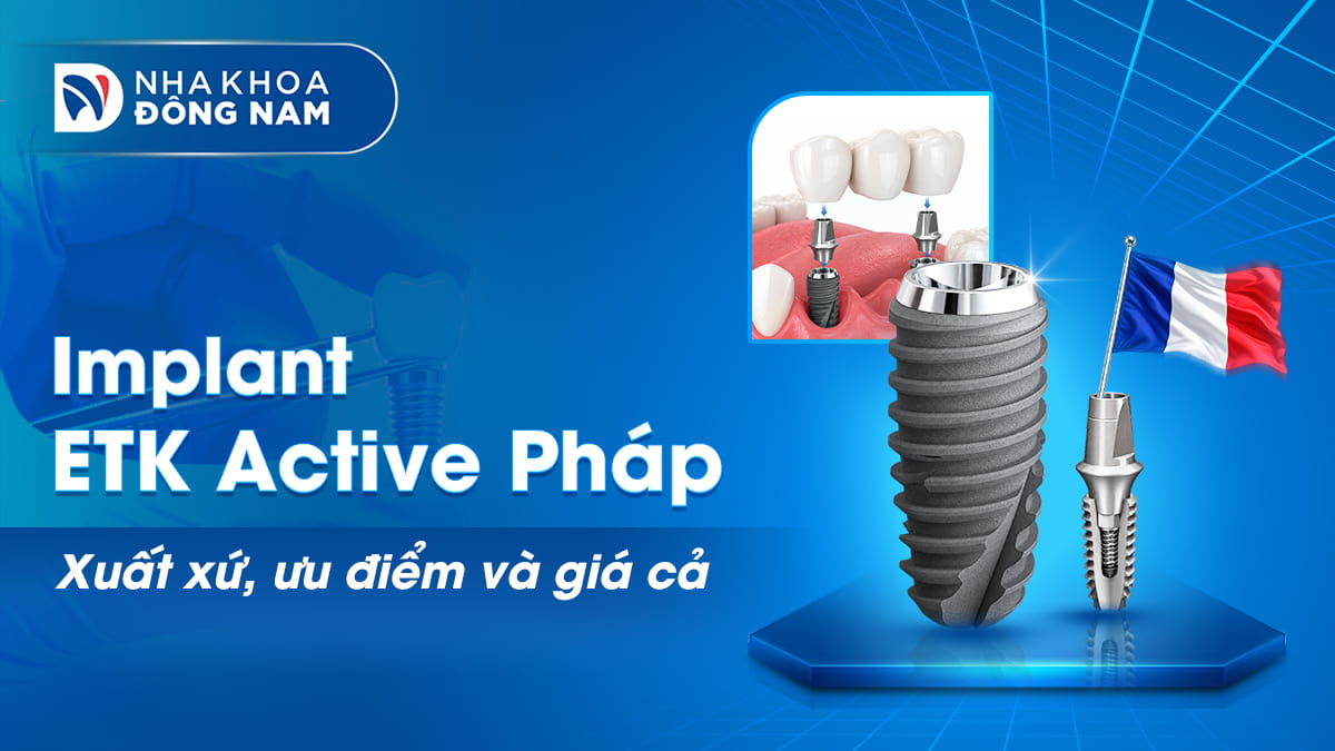 trụ etk pháp xuất xứ ưu điểm và giá cả