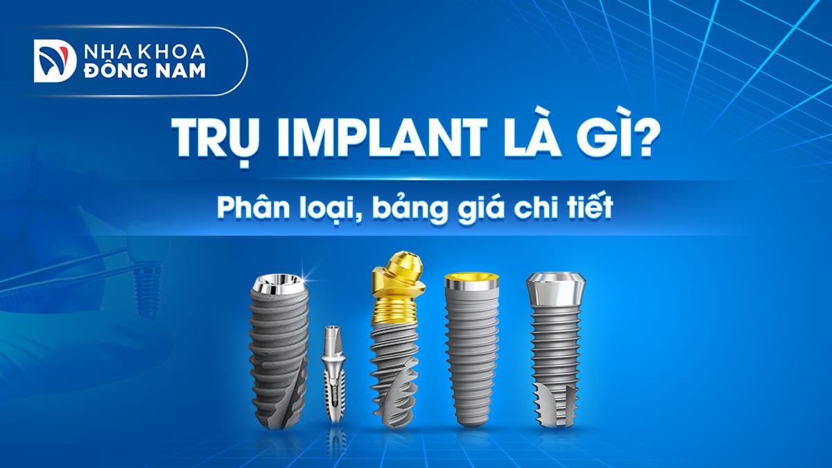 trụ implamt là gì phân loại và bảng giá chi tiết