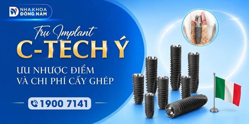Ưu nhược điểm và chi phí trụ implant c tech Ý