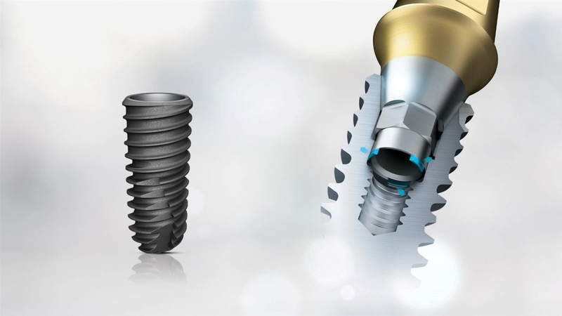 Trụ Implant mỹ là gì?