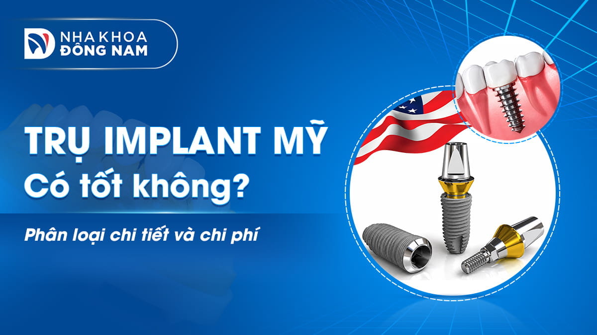 trụ implant mỹ phân loại và chi phí