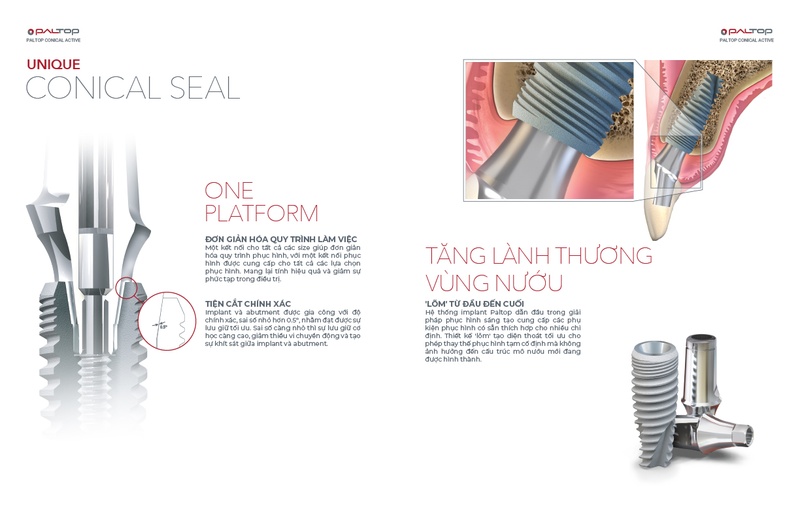 Trụ Implant Paltop mỹ