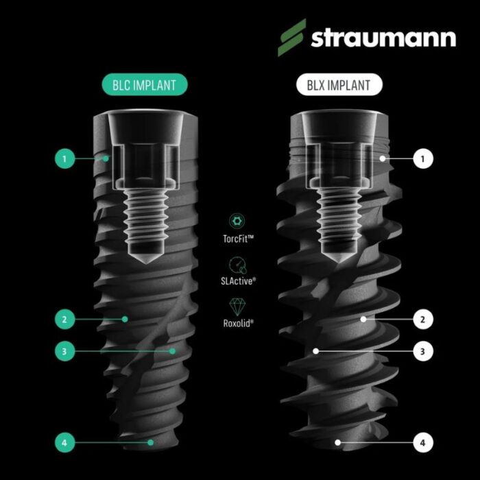 trụ implant straumann blx slactive thiết kế tối ưu cho các ca cấy ghép tức thì