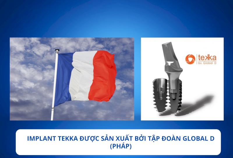 Trụ implant tekka được sản xuất tại pháp