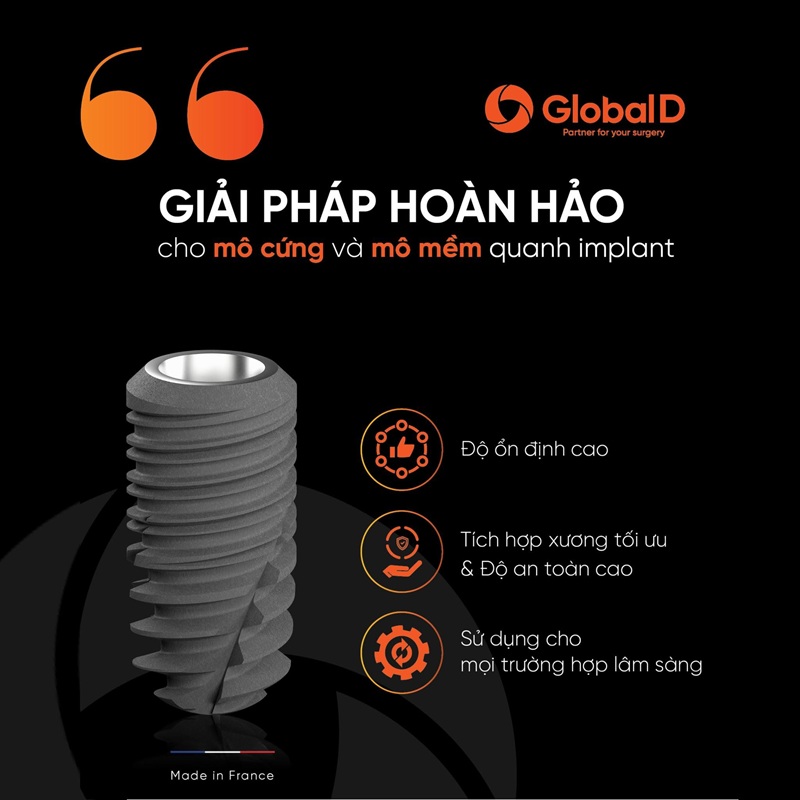 trụ implant tekka pháp