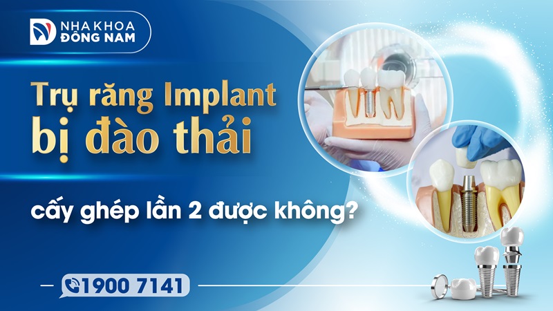 trụ răng implant bị đào thải cấy ghép lần 2 được không?